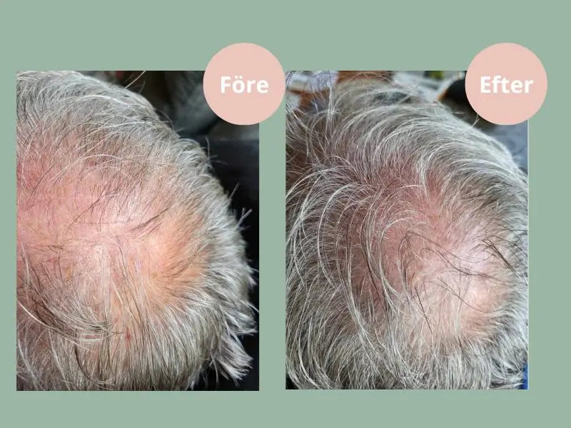 Hair Growth Balsam (250ml)