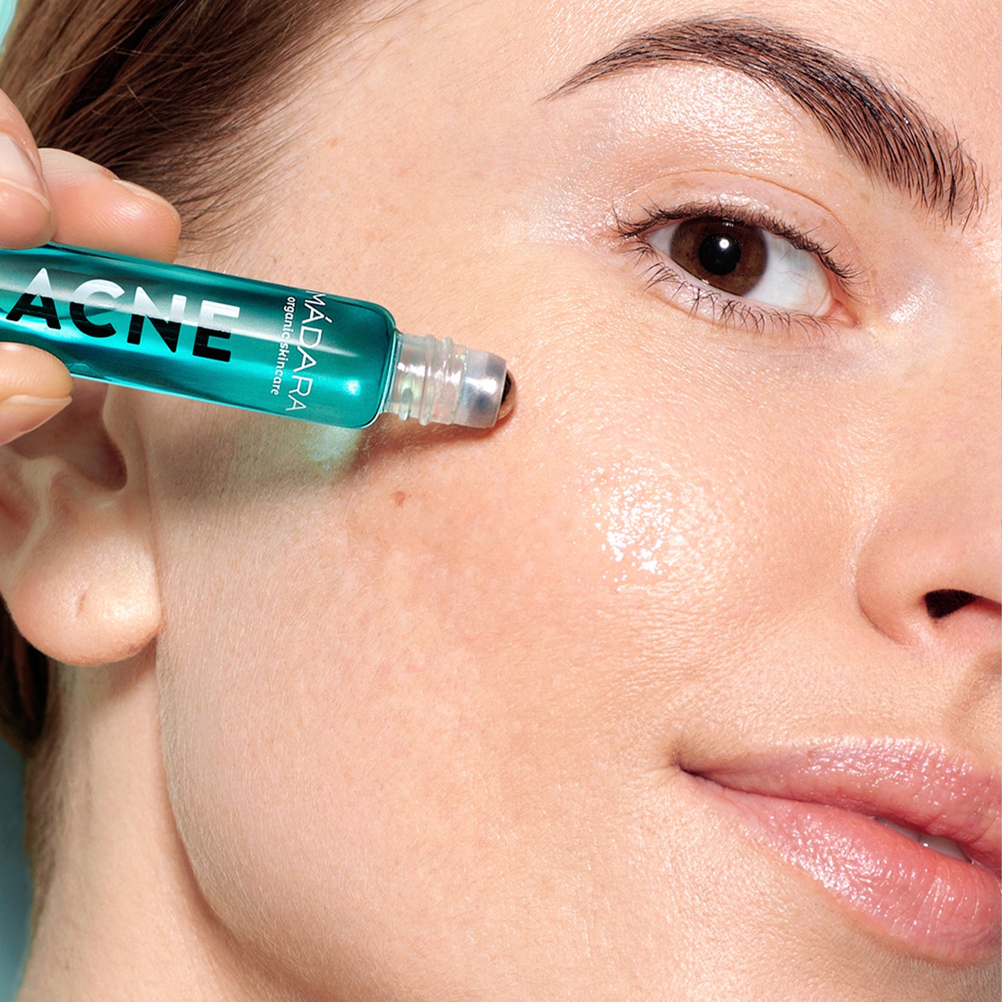 ACNE Spot Roll-On (8ml)