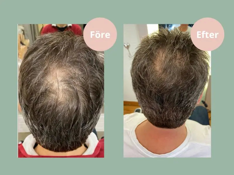 Hair Growth Balsam (250ml)