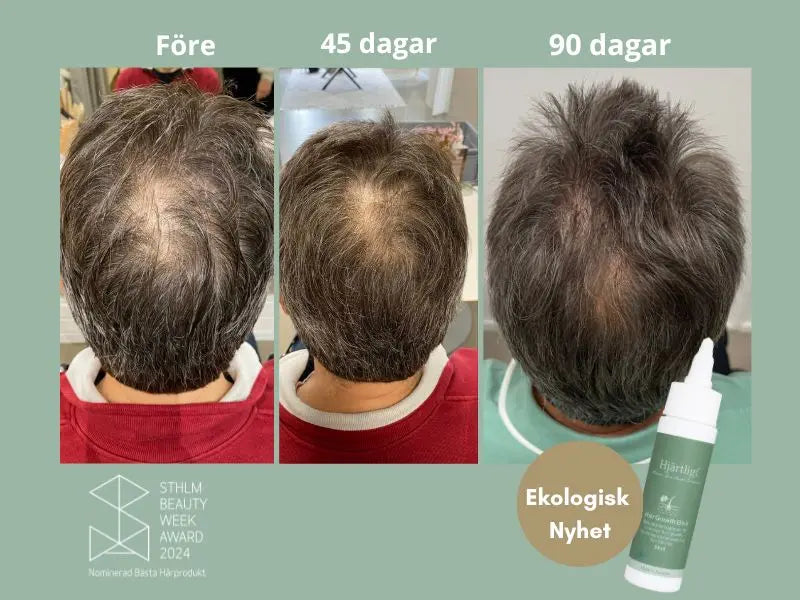 Hair Growth Elixir (50ml)